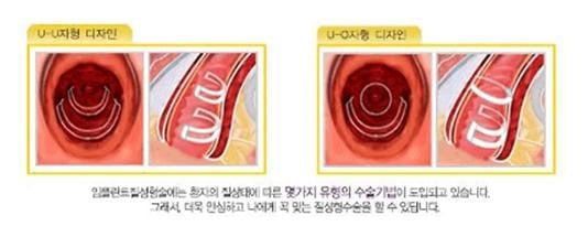 블로그 포켓 테스트...